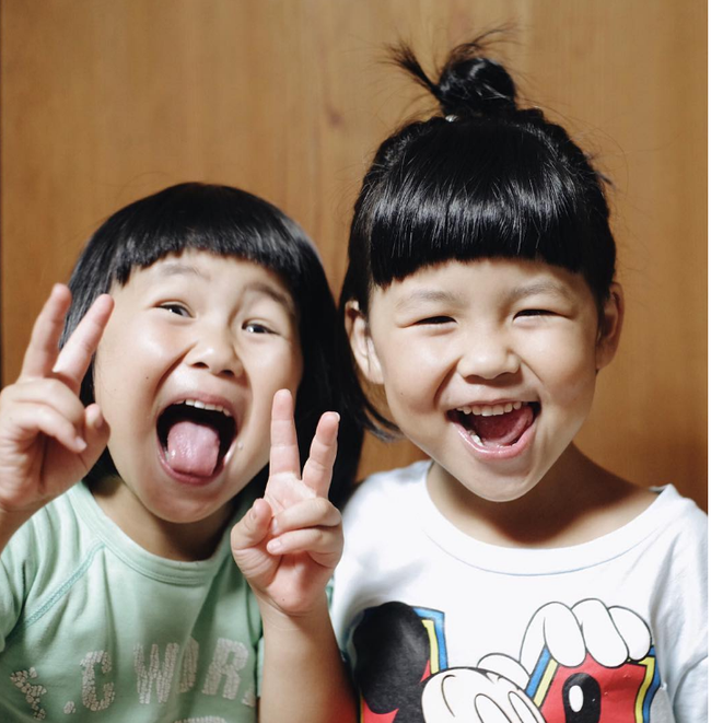 Cặp song sinh đầu b&aacute;t &uacute;p từng khiến cộng đồng mạng chao đảo ng&agrave;y n&agrave;o giờ đ&atilde; lớn nhưng vẫn cực cute - Ảnh 10.