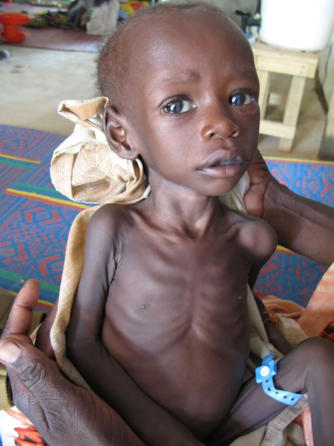 Chùm ảnh những đứa trẻ châu Phi gầy trơ xương vì đói sẽ khiến bạn không dám bỏ thừa đồ ăn thêm nữa - Ảnh 27.