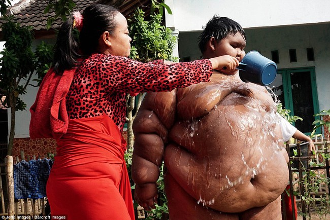 Cuộc sống nặng nề của cậu b&eacute; mới 10 tuổi m&agrave; đ&atilde; nặng 190kg - Ảnh 6.