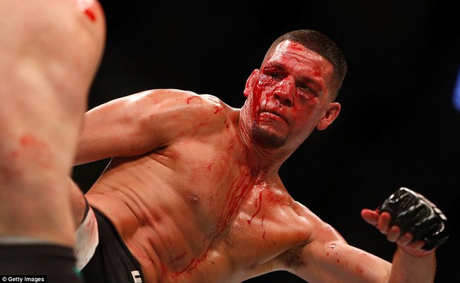 Gã điên McGregor phục thù thành công trong trận chiến đẫm máu với Nate Diaz - Ảnh 13.