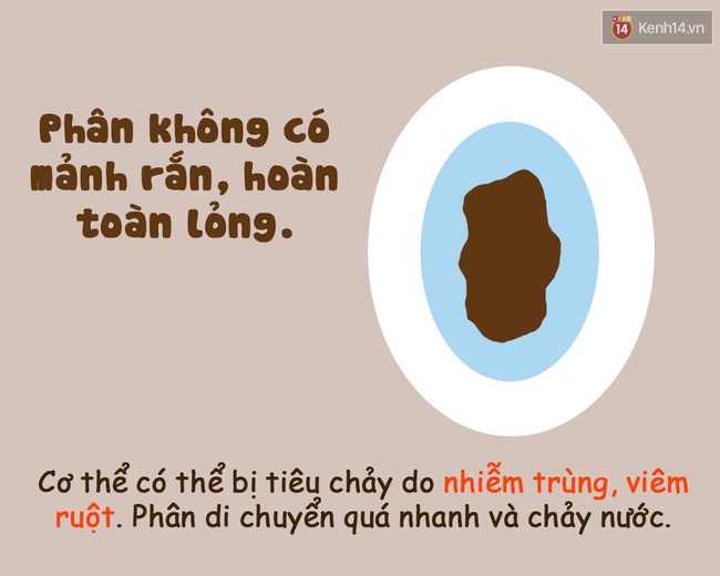 Xem hình dáng chất thải tế nhị biết ngay cơ thể bạn đang như thế nào! - Ảnh 4.