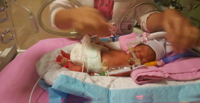 Người bố Việt kêu gọi giúp đỡ 4 tỷ cứu con trai sinh non ở tuần 26 tại Singapore - Ảnh 3.