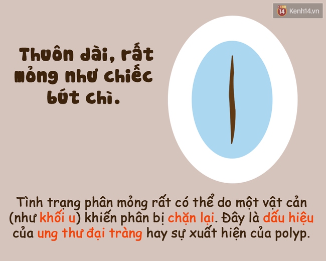 Xem hình dáng chất thải tế nhị biết ngay cơ thể bạn đang như thế nào! - Ảnh 6.