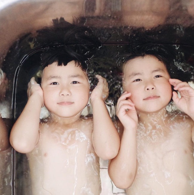 Cặp song sinh đầu b&aacute;t &uacute;p từng khiến cộng đồng mạng chao đảo ng&agrave;y n&agrave;o giờ đ&atilde; lớn nhưng vẫn cực cute - Ảnh 15.