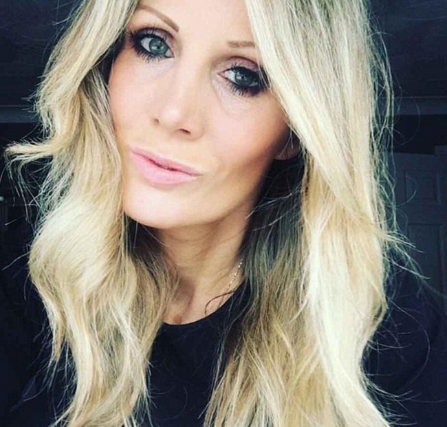 Kh&ocirc;ng chỉ ri&ecirc;ng nước m&igrave;nh đ&acirc;u, b&aacute;c sĩ thẩm mỹ ở Anh cũng biến l&uacute;m đồng tiền th&agrave;nh thảm họa thế n&agrave;y đ&acirc;y - Ảnh 3.