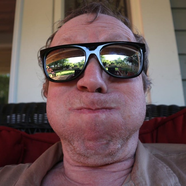 Tuyển tập 14 mẹo d&acirc;n gian đậm m&ugrave;i hư cấu nhưng chữa nấc cụt cực nhanh - Ảnh 15.