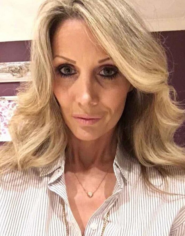 Kh&ocirc;ng chỉ ri&ecirc;ng nước m&igrave;nh đ&acirc;u, b&aacute;c sĩ thẩm mỹ ở Anh cũng biến l&uacute;m đồng tiền th&agrave;nh thảm họa thế n&agrave;y đ&acirc;y - Ảnh 5.