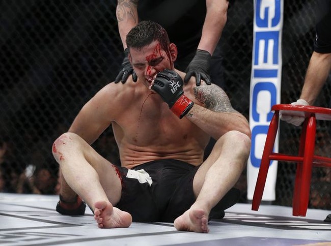 Nhà cựu vô địch UFC đầm đìa máu sau cú bay người lên gối tàn khốc của đối thủ - Ảnh 4.