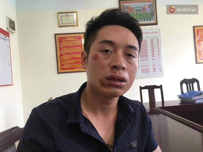 Hà Nội: Bị chặn bắt vì không đội mũ bảo hiểm, nam thanh niên đánh gãy răng CSGT - Ảnh 2.