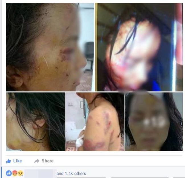 Phú Thọ: Cô giáo trẻ bị chồng đánh đập thương tích đầy người - Ảnh 1.