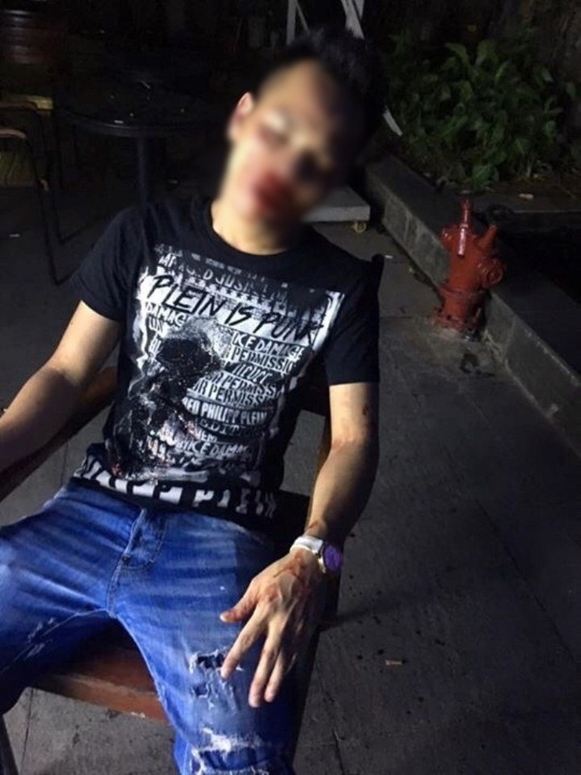 Hà Nội: Cô gái mang bầu 2 tháng tố bị nhân viên quán bar Q-Club đánh nhập viện - Ảnh 2.