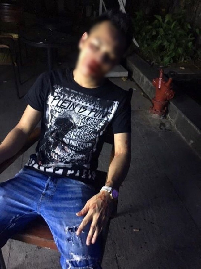 H&agrave; Nội: C&ocirc; g&aacute;i mang bầu 2 th&aacute;ng tố bị nh&acirc;n vi&ecirc;n qu&aacute;n bar Q-Club đ&aacute;nh nhập viện - Ảnh 2.