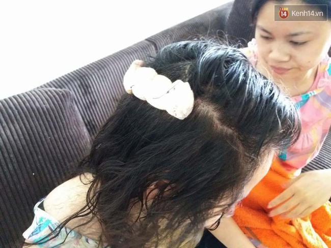 Hà Nội: Cô gái trẻ bị cướp giật túi xách, bất tỉnh trên đường Giải Phóng - Ảnh 4.