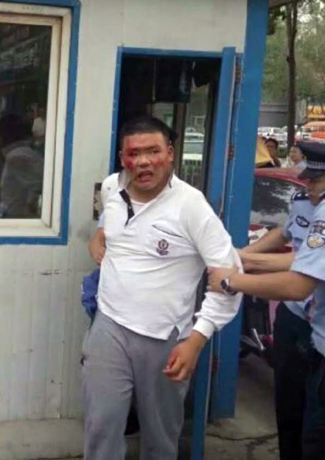 Hi hữu: Người đi bộ c&oacute; t&acirc;m khiến đo&agrave;n đua kh&oacute;c hận - Ảnh 7.