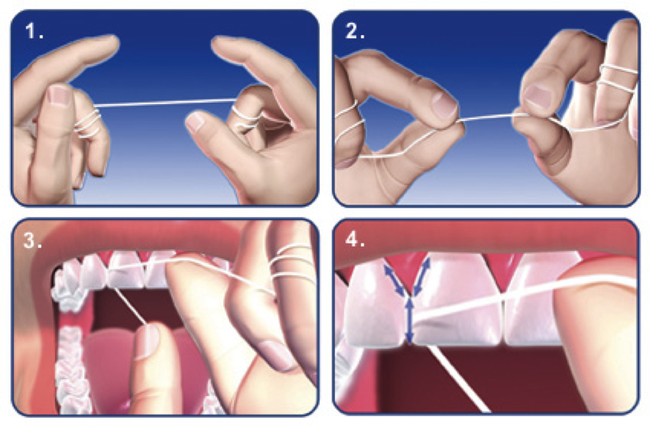 Bí kíp của nha sĩ: làm sao để một hàm răng trắng bóng không cần thẩm mỹ - Ảnh 1.