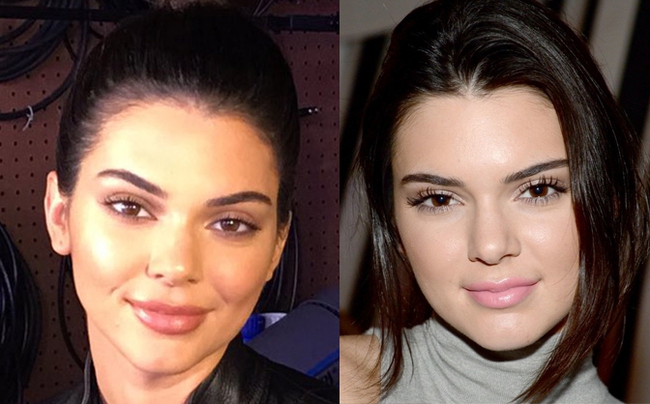 Kendall Jenner cũng đã tiếp bước Kylie đến thẩm mỹ viện bơm môi rồi sao? - Ảnh 2.