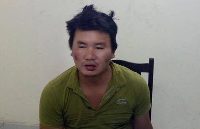 Lời khai kẻ khống chế con tin, đ&acirc;m trọng thương trưởng c&ocirc;ng an phường khi đi chăm vợ bệnh - Ảnh 1.