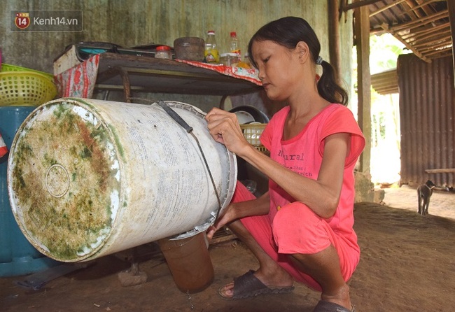 Cô gái mang khuôn mặt bà lão ở Quảng Nam: ăn gấp 10 lần người thường, uống mỗi ngày 36 lít nước - Ảnh 7.