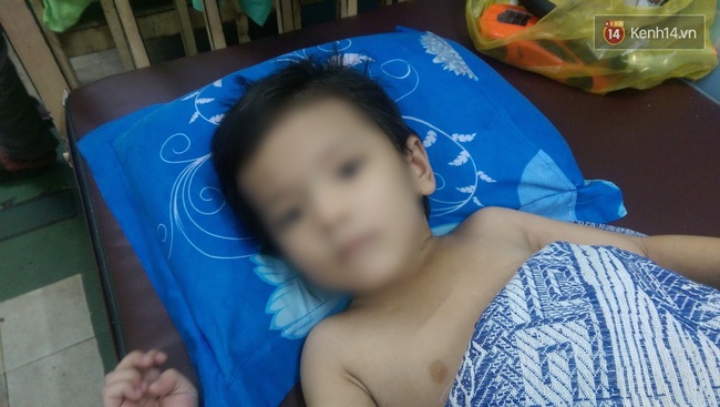 Nghịch ngợm, bé trai 5 tuổi bị bố dượng và mẹ ruột đánh gãy chân - Ảnh 1.