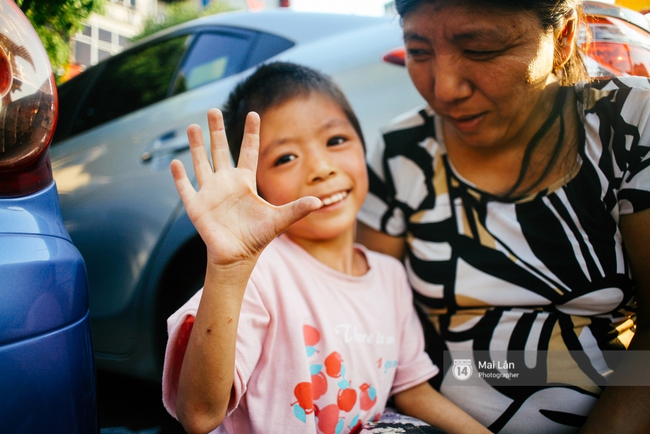 C&ocirc; b&eacute; bị lở lo&eacute;t khắp người vẫn h&agrave;ng ng&agrave;y theo mẹ đi b&aacute;n b&oacute;ng bay ở H&agrave; Nội giờ ra sao? - Ảnh 2.