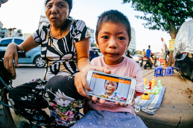 C&ocirc; b&eacute; bị lở lo&eacute;t khắp người vẫn h&agrave;ng ng&agrave;y theo mẹ đi b&aacute;n b&oacute;ng bay ở H&agrave; Nội giờ ra sao? - Ảnh 3.