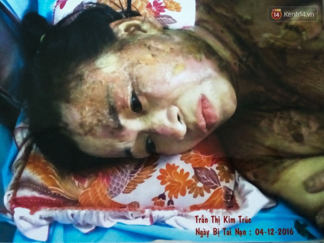 Không móc cống nghẹt, người phụ nữ ở Sài Gòn bị tạt nồi thịt sôi vào người gây bỏng nặng - Ảnh 2.