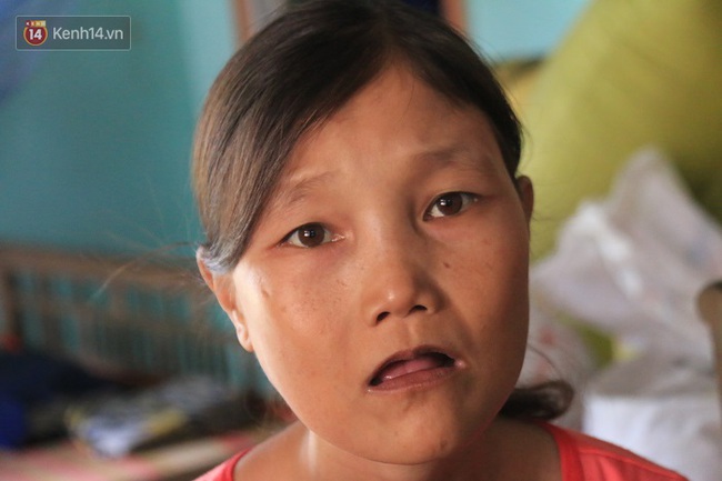 Cô gái mang khuôn mặt bà lão ở Quảng Nam: ăn gấp 10 lần người thường, uống mỗi ngày 36 lít nước - Ảnh 10.