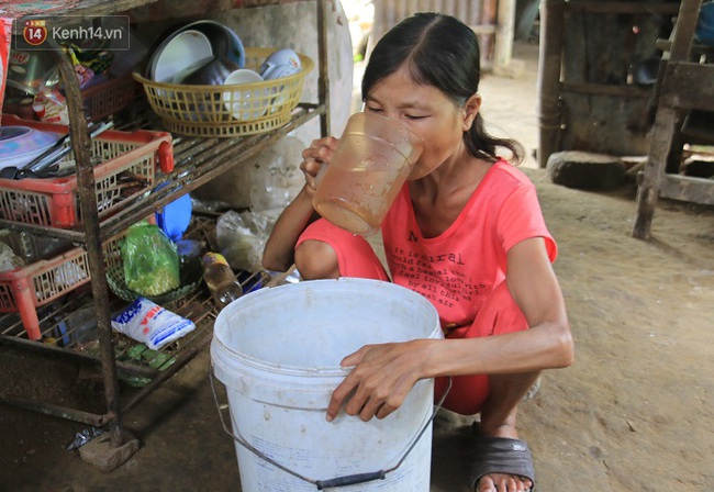 Cô gái mang khuôn mặt bà lão ở Quảng Nam: ăn gấp 10 lần người thường, uống mỗi ngày 36 lít nước - Ảnh 6.