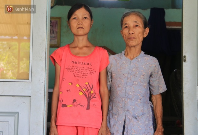 Cô gái mang khuôn mặt bà lão ở Quảng Nam: ăn gấp 10 lần người thường, uống mỗi ngày 36 lít nước - Ảnh 3.
