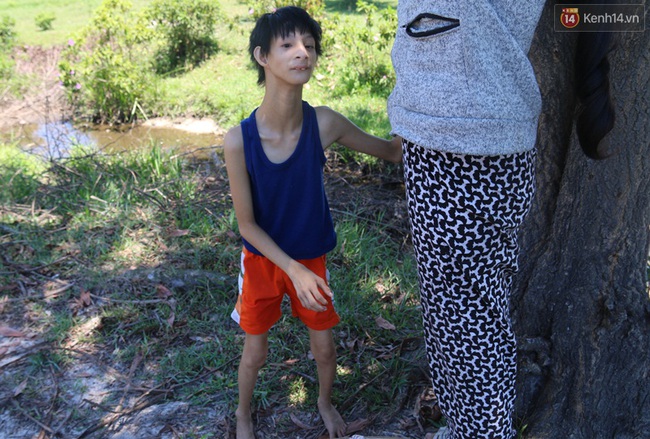 Cuộc sống cùng cực của cậu bé người khỉ 14 tuổi nhưng chỉ cao 0,8 mét, nặng 7kg ở Huế - Ảnh 1.