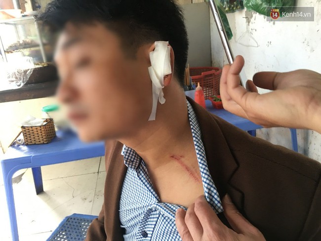H&agrave; Nội: Thắc mắc sao kh&ocirc;ng c&oacute; chỗ đỗ xe, cư d&acirc;n chung cư bị bảo vệ đ&aacute;nh r&aacute;ch tai - Ảnh 1.