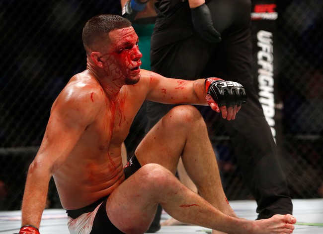 Gã điên McGregor phục thù thành công trong trận chiến đẫm máu với Nate Diaz - Ảnh 12.