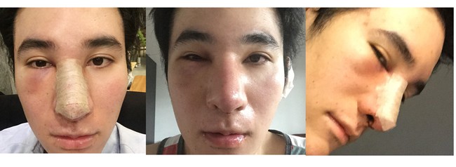 Mỹ nam Th&aacute;i Lan c&ocirc;ng khai loạt ảnh đập mặt đi x&acirc;y lại của m&igrave;nh - Ảnh 4.