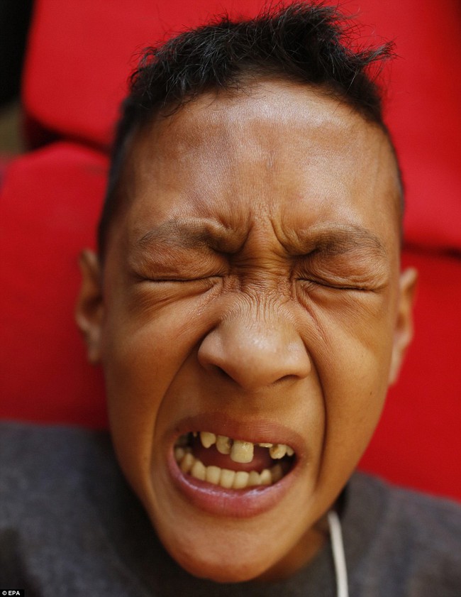 Chùm ảnh: 300 cậu bé đau đớn trong nghi thức cắt bao quy đầu tại Philippines - Ảnh 1.