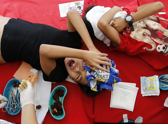 Chùm ảnh: 300 cậu bé đau đớn trong nghi thức cắt bao quy đầu tại Philippines - Ảnh 4.