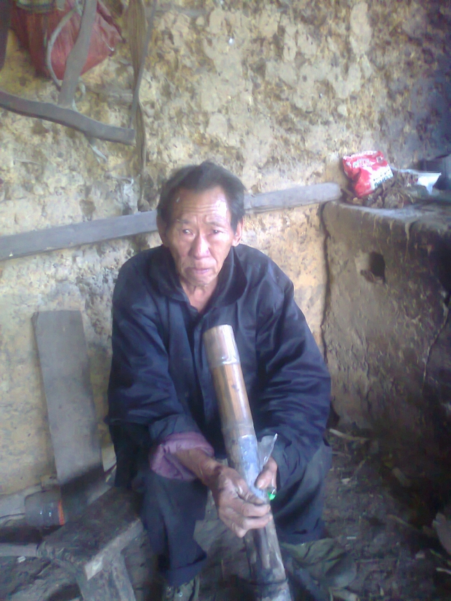 Người mọc đu&ocirc;i ở H&agrave; Giang: Vừa cắt đu&ocirc;i th&igrave; lăn ra... ốm - Ảnh 2.
