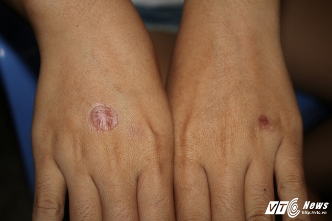 Nữ sinh run sợ kể ph&uacute;t bị bạn ch&acirc;m thuốc l&aacute; v&agrave;o tay, bắt liếm ch&acirc;n - Ảnh 3.