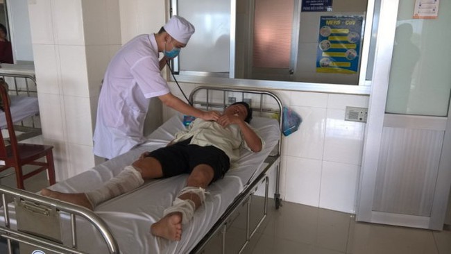 Một c&ocirc;ng an vi&ecirc;n bị đốt khi đang ngủ - Ảnh 3.