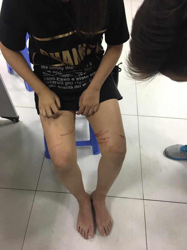 Nghi vấn: Xuất hiện đối tượng rạch đ&ugrave;i thiếu nữ tại H&agrave; Nội? - Ảnh 1.