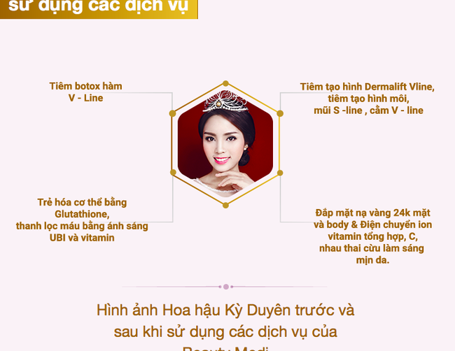 Thẩm mỹ viện đăng tải quảng c&aacute;o: Chiếc cằm nhọn hiện nay của Kỳ Duy&ecirc;n kh&ocirc;ng phải l&agrave; sản phẩm từ ch&uacute;ng t&ocirc;i - Ảnh 2.