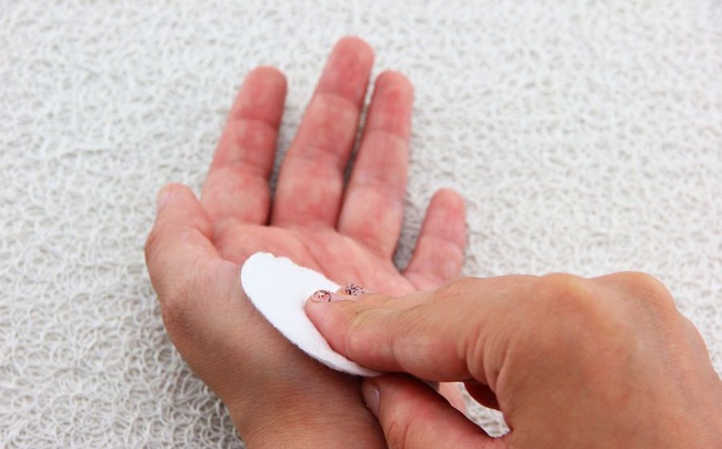 Đ&aacute;nh bay vết muỗi đốt tức th&igrave; chỉ bằng một chiếc th&igrave;a - Ảnh 1.