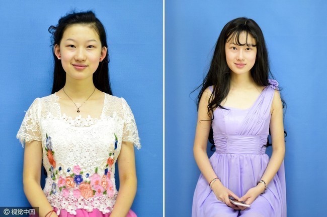 Cô gái 19 tuổi bất chấp tất cả phẫu thuật để trở thành Lưu Diệc Phi thứ hai - Ảnh 2.