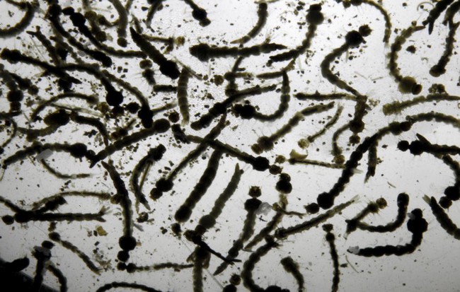 Ch&ugrave;m ảnh: khi virus Zika gieo rắc nỗi kinh ho&agrave;ng tr&ecirc;n to&agrave;n thế giới - Ảnh 14.