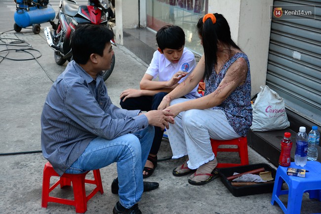 Người phụ nữ v&aacute; xe mang những vết sẹo khủng khiếp v&igrave; bị tạt axit: T&ocirc;i kh&ocirc;ng được nghĩ đến c&aacute;i chết, n&ecirc;n phải sống! - Ảnh 8.