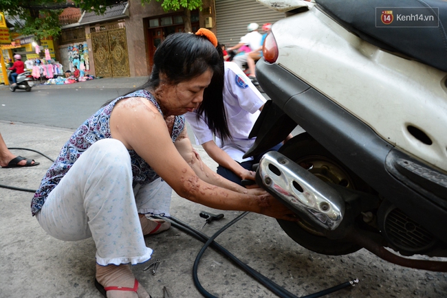 Người phụ nữ v&aacute; xe mang những vết sẹo khủng khiếp v&igrave; bị tạt axit: T&ocirc;i kh&ocirc;ng được nghĩ đến c&aacute;i chết, n&ecirc;n phải sống! - Ảnh 6.