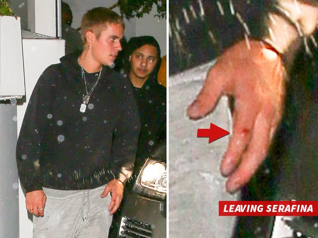 Justin Bieber bị cảnh sát điều tra vì đánh nhau đến chảy máu ở tiệc tiền Grammy - Ảnh 1.