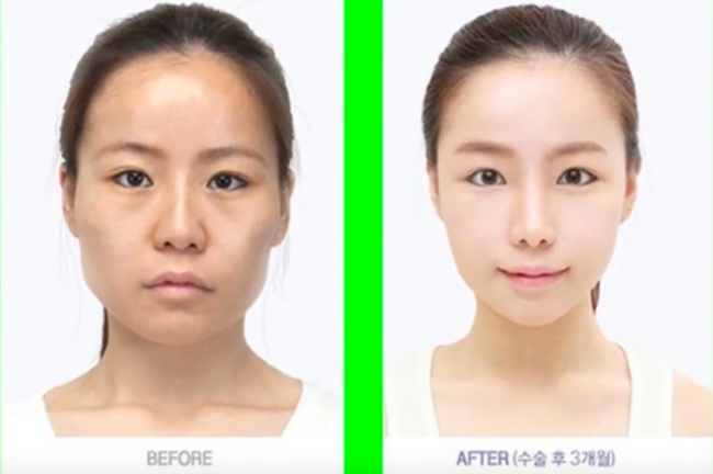 Con g&aacute;i v&agrave; những pha lột x&aacute;c ngoạn mục nhờ phẫu thuật thẩm mỹ! - Ảnh 7.