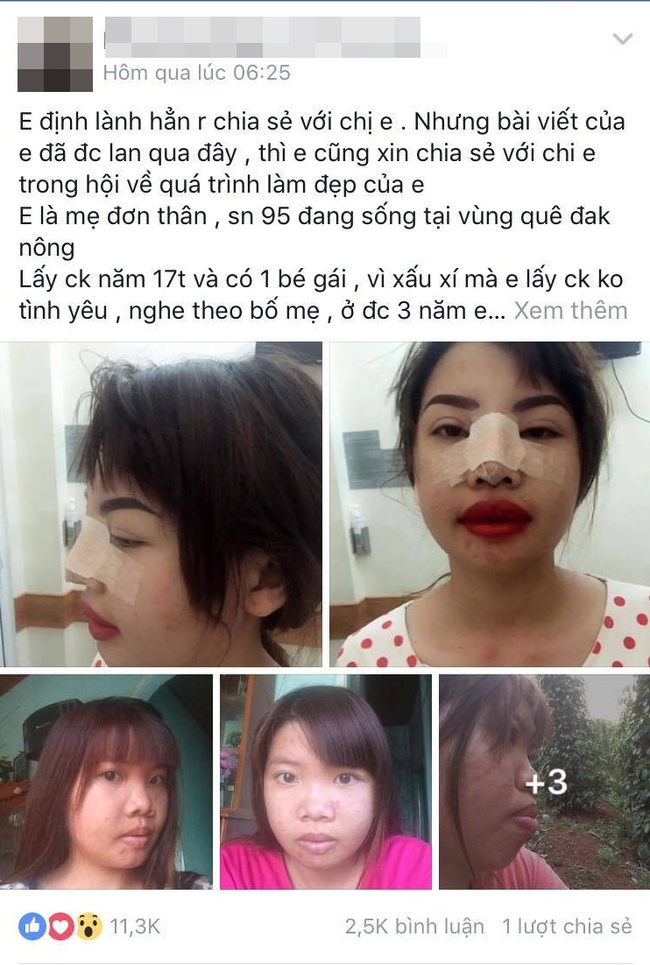 Bà mẹ đơn thân đã trải qua một cuộc sống khó khăn và đầy thử thách. Nhưng với phẫu thuật thẩm mỹ, cô đã có cơ hội để cải thiện sự tự tin và tình yêu bản thân. Xem ảnh này để khám phá câu chuyện đầy cảm hứng của bà mẹ đơn thân này.