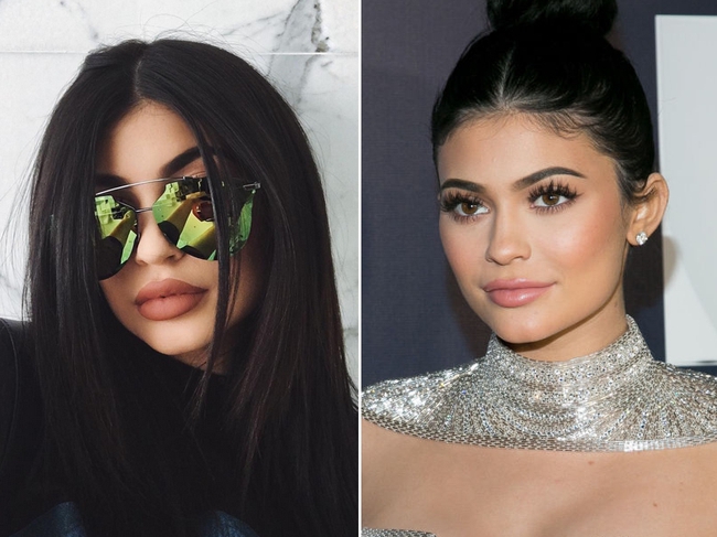 Cặp môi của Kylie Jenner tiếp tục trở thành chủ đề bàn tán, nhưng lần này là vì trông... mỏng hơn hẳn - Ảnh 3.