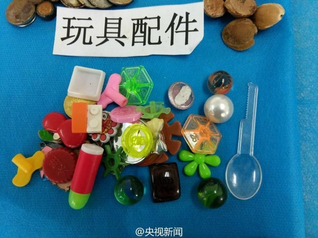 Bạn kh&ocirc;ng thể h&igrave;nh dung được con m&igrave;nh sẽ nuốt phải những g&igrave; chỉ sau v&agrave;i gi&acirc;y bất cẩn - Ảnh 3.